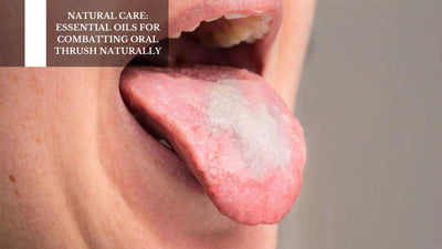 Natural Care: Essential Oils For Combatting Oral Thrush Naturally