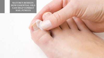 Nature's Remedy: How Essential Oils Can Help Combat Nail Fungus