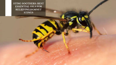 Sting Soothers: Best Essential Oils For Relieving Hornet Stings