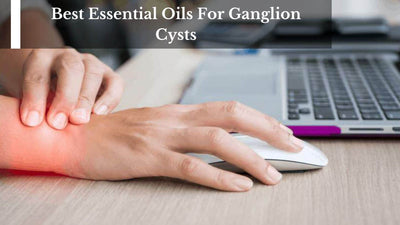 Best Essential Oils For Ganglion Cysts