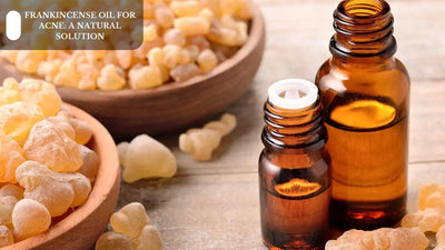 Frankincense Oil For Acne: A Natural Solution