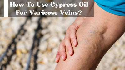 How To Use Cypress Oil For Varicose Veins?