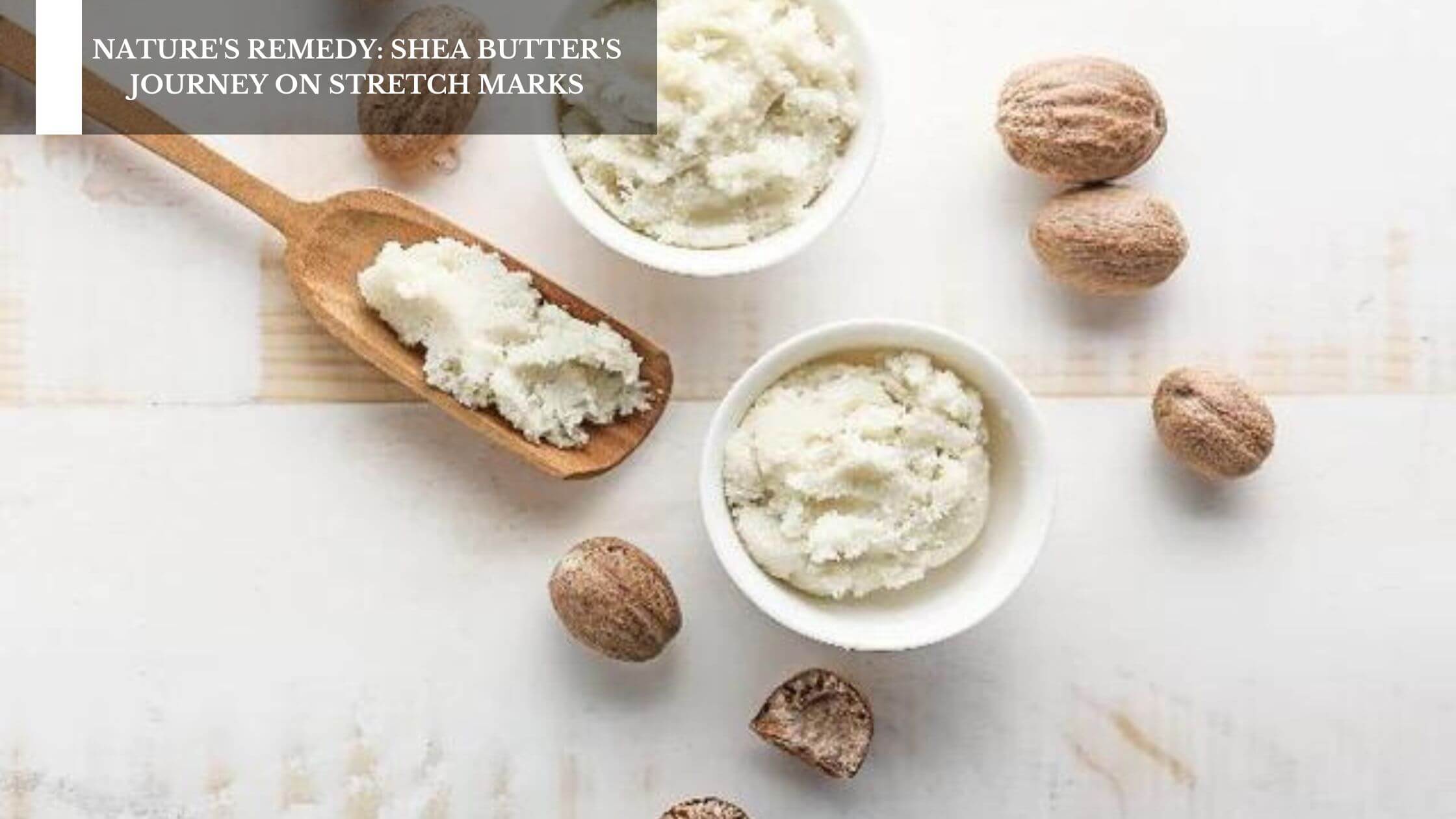Nature's Remedy Shea Butter's Journey On Stretch Marks Moksha Lifestyle Products