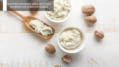 Nature's Remedy: Shea Butter's Journey On Stretch Marks
