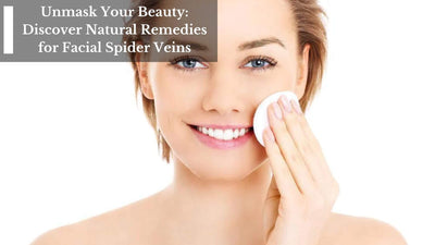 Unmask Your Beauty: Discover Natural Remedies for Facial Spider Veins
