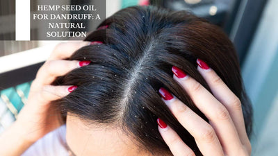 Hemp Seed Oil For Dandruff: A Natural Solution