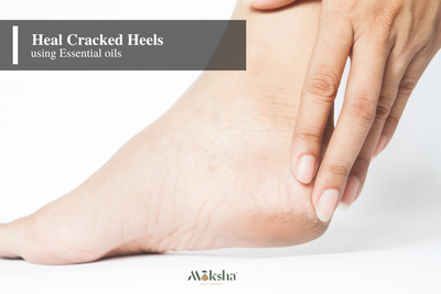 Top Essential oils for Cracked Heels I Soften your feet using natural oils