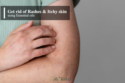 Essential Oils for Rashes I Best Antifungal Itch oil for Skin Rash